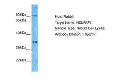 NDUFAF1 Rabbit anti-Human, Polyclonal, Novus Biologicals 0.1 mL | Buy Online | Novus Biologicals | Fisher Scientific